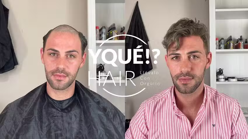 PROTESIS CAPILARES Y PELUCAS YQU&Eacute;!? HAIR